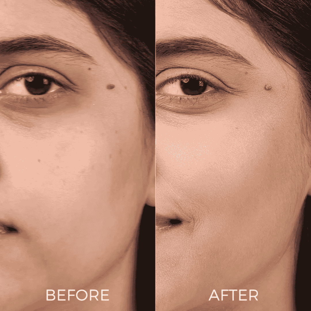 Before and after results showing smoother skin using Age Revival Serum Mist For Ageing Skin.