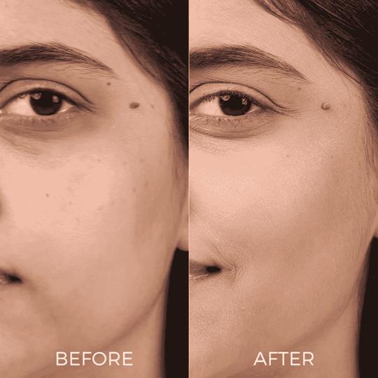Before and after results showing smoother skin using Age Revival Serum Mist For Ageing Skin.
