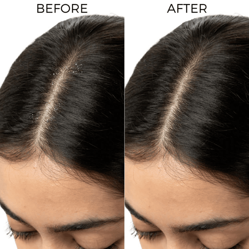 Brillare, Lactylate, Anti Dandruff, Ayurveda Store NZ