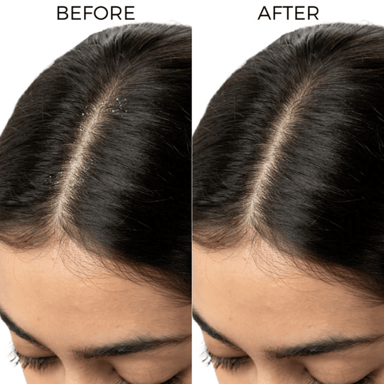 Brillare, Lactylate, Anti Dandruff, Ayurveda Store NZ