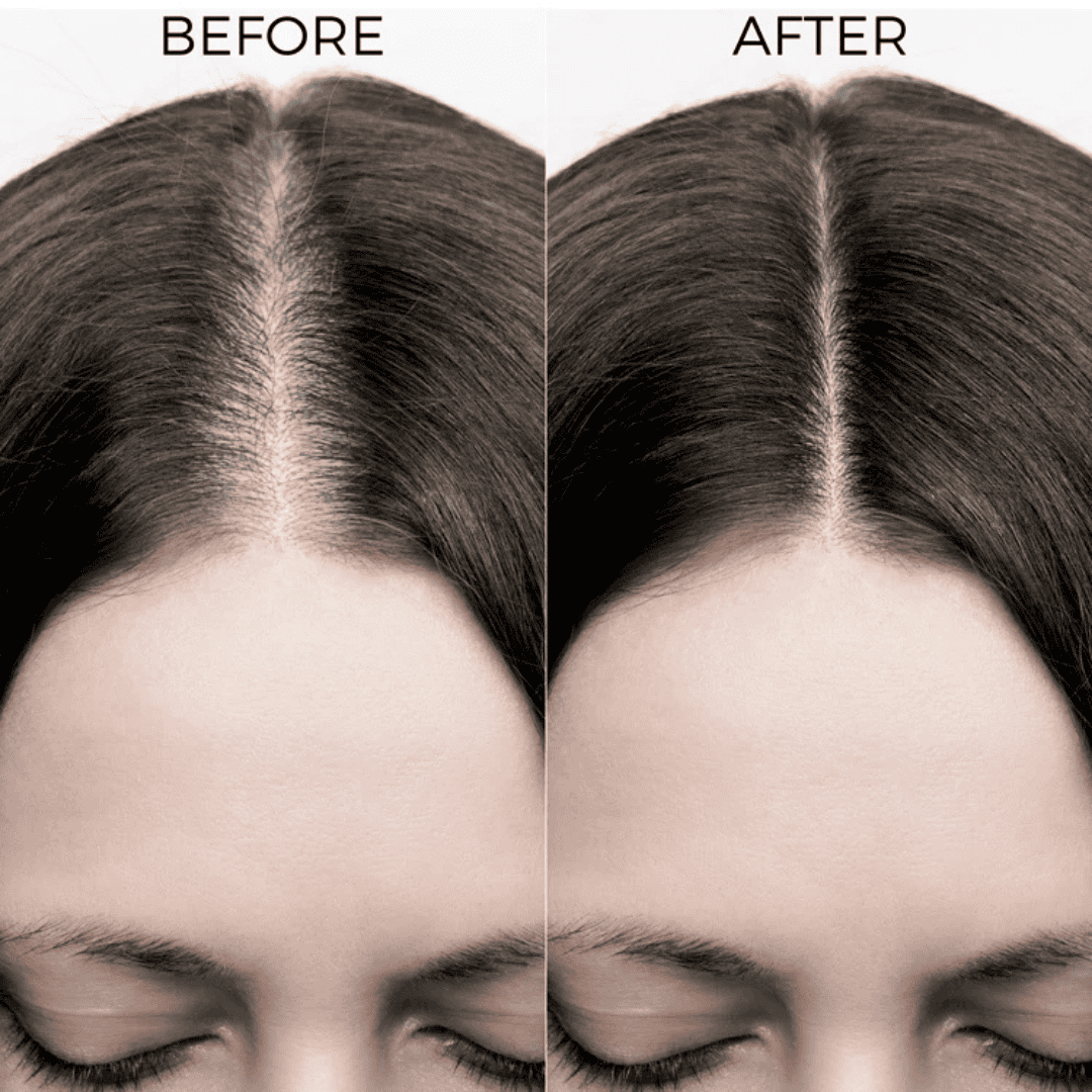 Brillare, Caffeine, Shampoo, For Hair Loss, For Breakage, Ayurveda Store NZ
