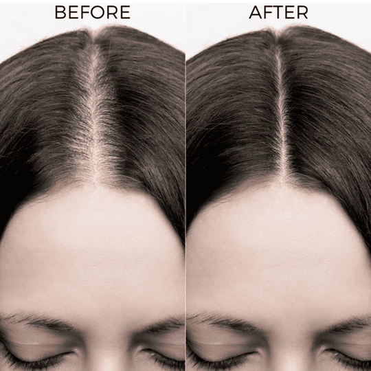 Brillare, Caffeine, Shampoo, For Hair Loss, For Breakage, Ayurveda Store NZ